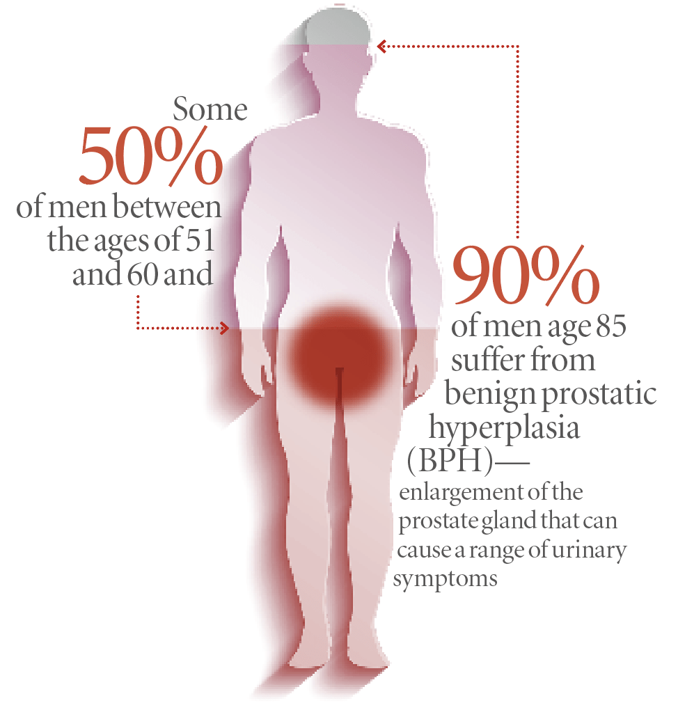 Supplements for a healthy prostate
