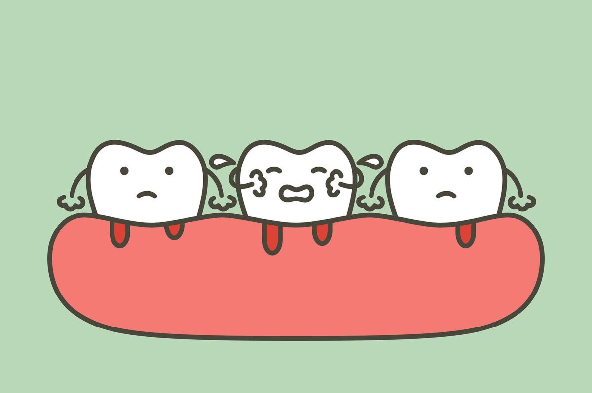 bleeding gums suggest a vitamin C deficiency