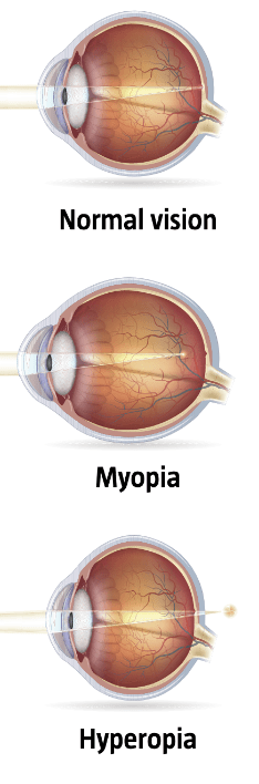 How the eye works